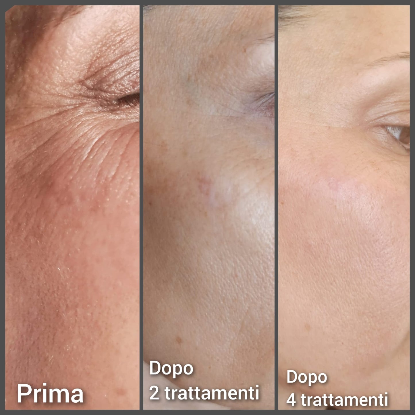 Pigment Therapy
