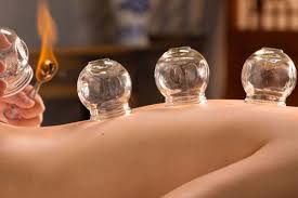 Cupping